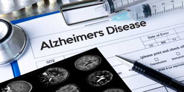 Recognizing Early Alzheimer’s Symptoms In Loved Ones